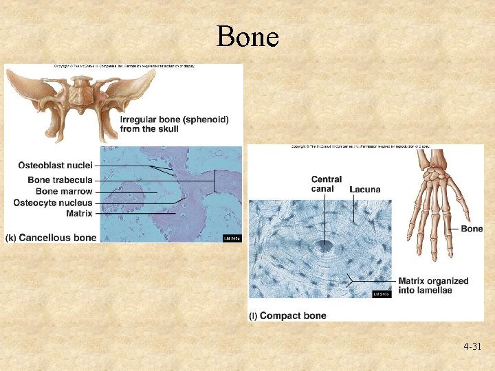 Bone 4 -31 