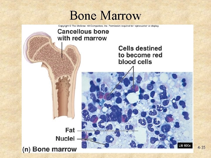 Bone Marrow 4 -35 