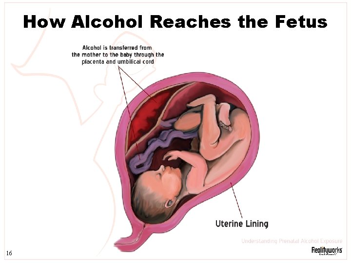 How Alcohol Reaches the Fetus 16 
