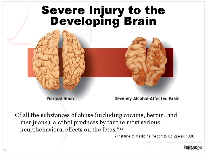 Severe Injury to the Developing Brain “Of all the substances of abuse (including cocaine,