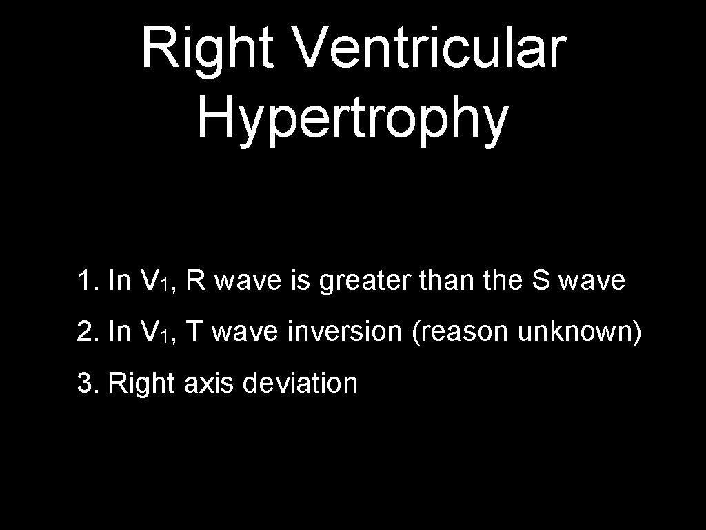 Right Ventricular Hypertrophy 1. In V 1, R wave is greater than the S