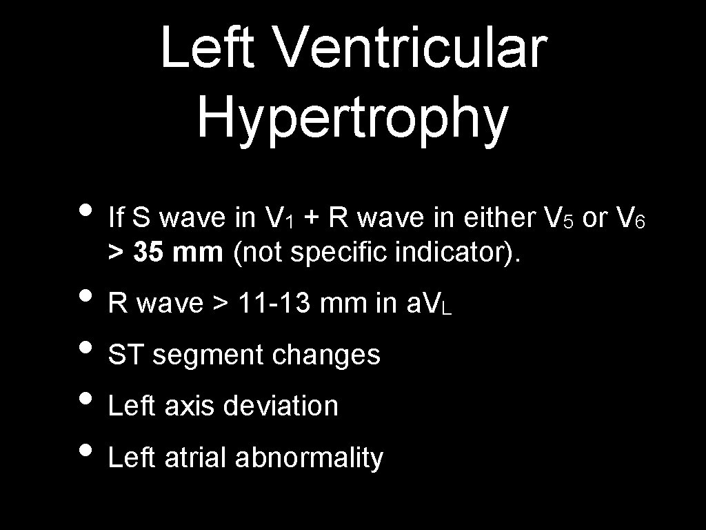 Left Ventricular Hypertrophy • If S wave in V + R wave in either