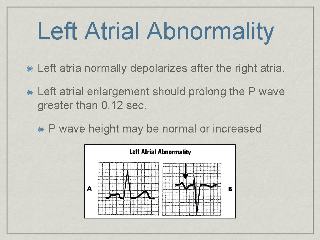 Left Atrial Abnormality Left atria normally depolarizes after the right atria. Left atrial enlargement