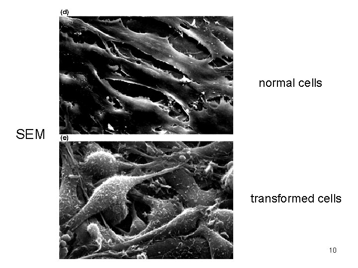 normal cells SEM transformed cells 10 