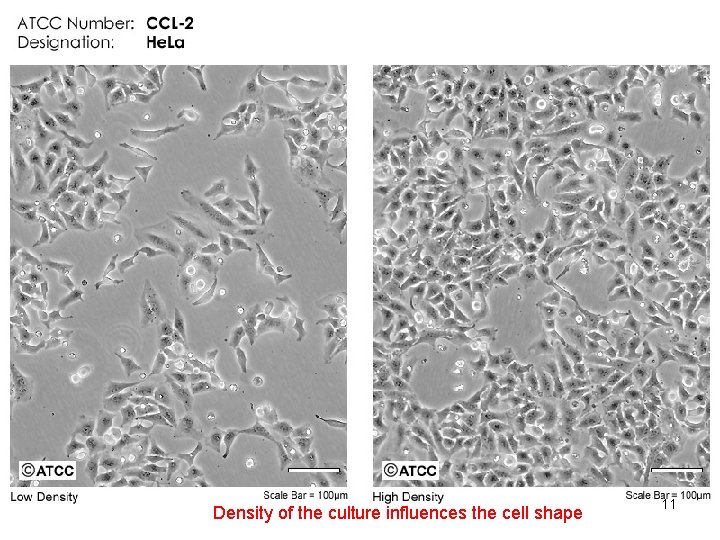 Density of the culture influences the cell shape 11 