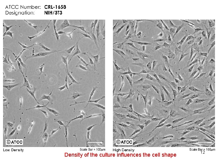 Density of the culture influences the cell shape 12 