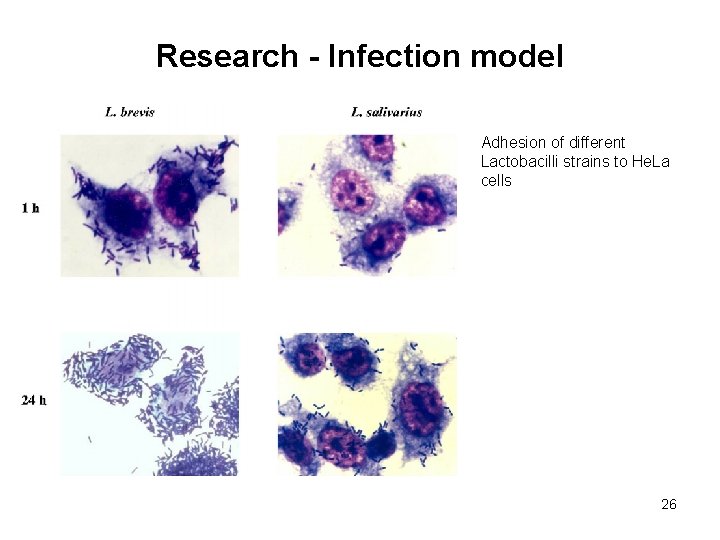 Research - Infection model Adhesion of different Lactobacilli strains to He. La cells 26