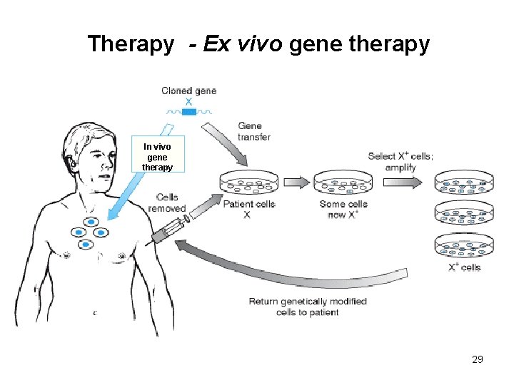 Therapy - Ex vivo gene therapy In vivo gene therapy 29 