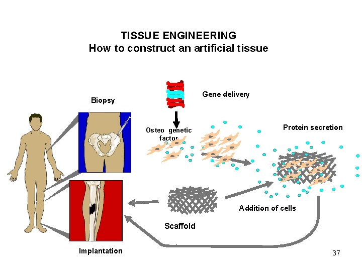 TISSUE ENGINEERING How to construct an artificial tissue Gene delivery Biopsy Osteo genetic factor