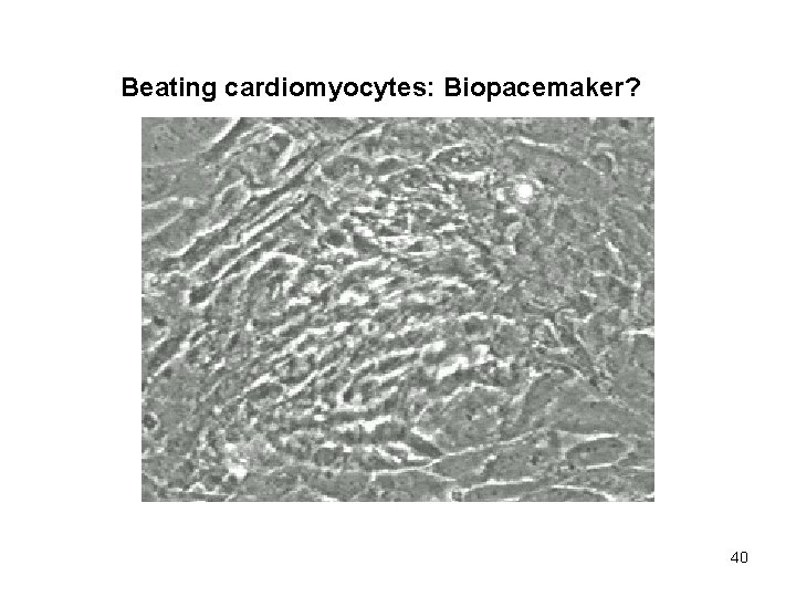 Beating cardiomyocytes: Biopacemaker? 40 