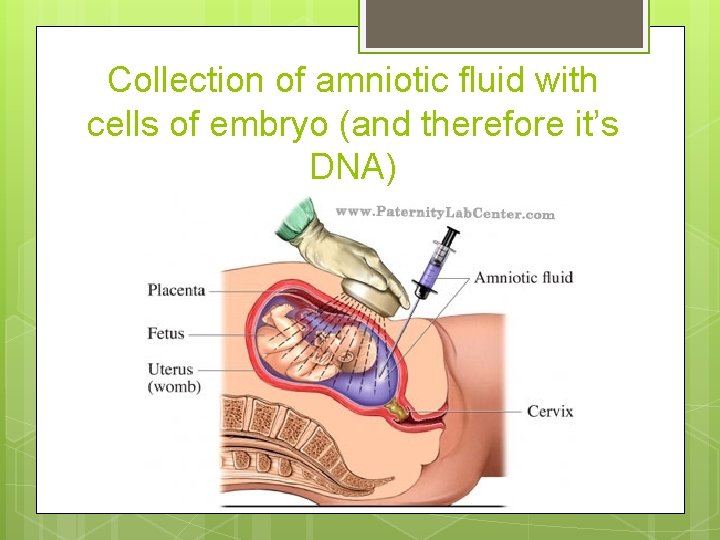 Collection of amniotic fluid with cells of embryo (and therefore it’s DNA) 