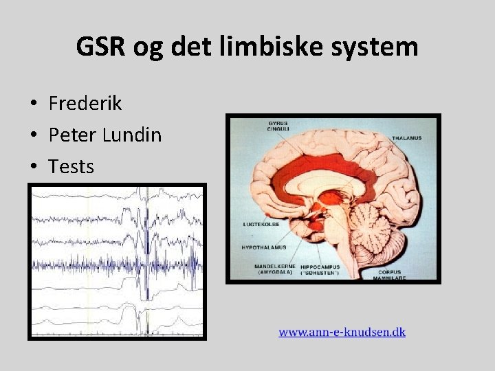 GSR og det limbiske system • Frederik • Peter Lundin • Tests 