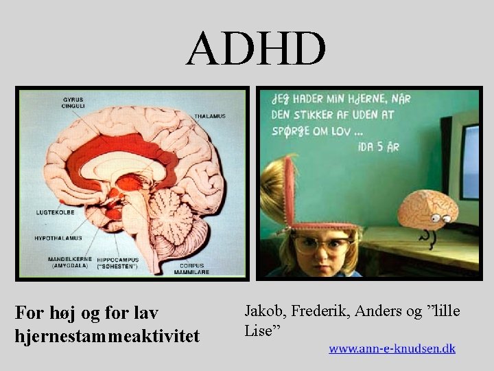 ADHD For høj og for lav hjernestammeaktivitet Jakob, Frederik, Anders og ”lille Lise” 
