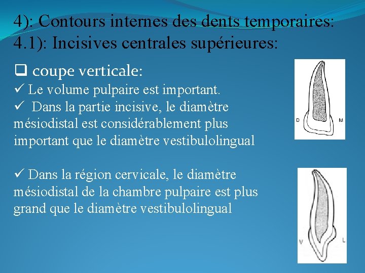 4): Contours internes dents temporaires: 4. 1): Incisives centrales supérieures: q coupe verticale: ü