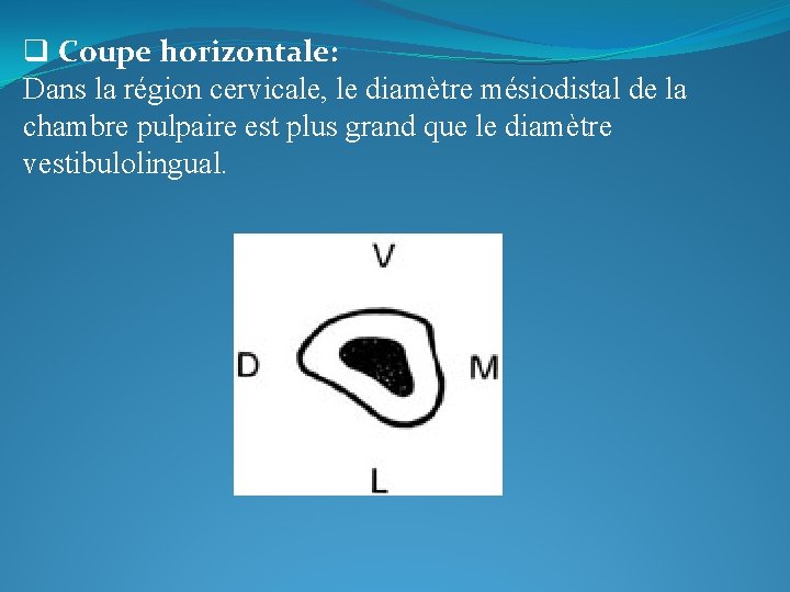 q Coupe horizontale: Dans la région cervicale, le diamètre mésiodistal de la chambre pulpaire