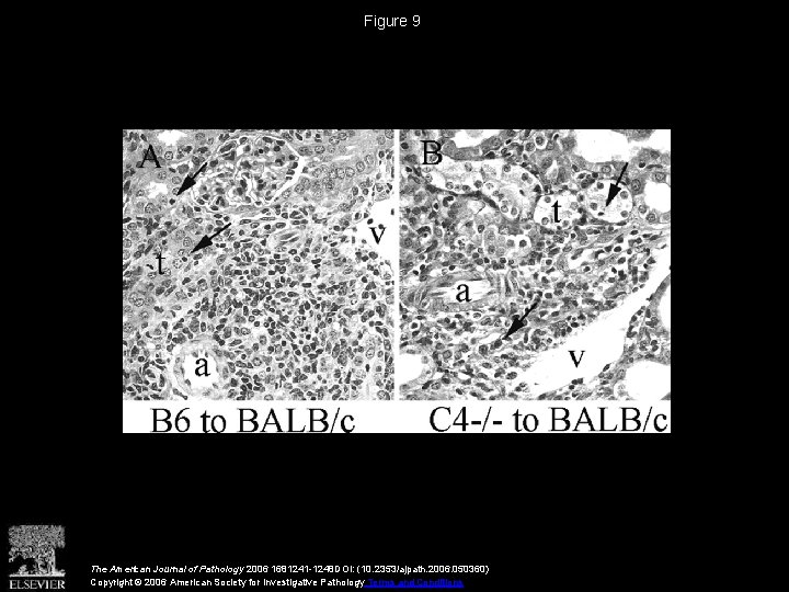 Figure 9 The American Journal of Pathology 2006 1681241 -1248 DOI: (10. 2353/ajpath. 2006.