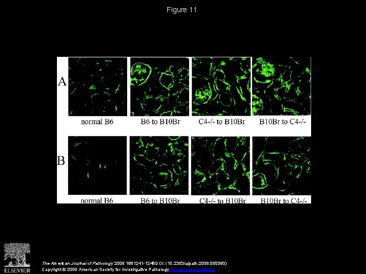 Figure 11 The American Journal of Pathology 2006 1681241 -1248 DOI: (10. 2353/ajpath. 2006.