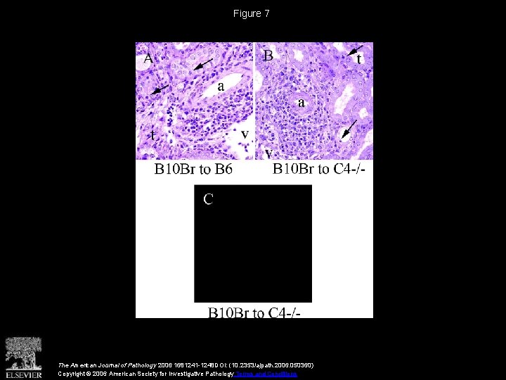 Figure 7 The American Journal of Pathology 2006 1681241 -1248 DOI: (10. 2353/ajpath. 2006.