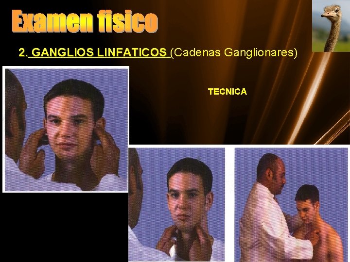 2. GANGLIOS LINFATICOS (Cadenas Ganglionares) TECNICA 
