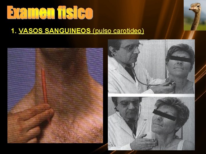 1. VASOS SANGUINEOS (pulso carotideo) 