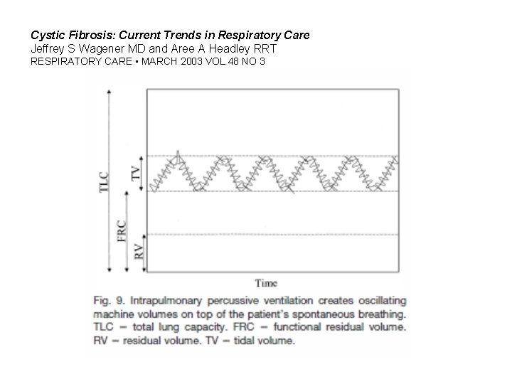 Cystic Fibrosis: Current Trends in Respiratory Care Jeffrey S Wagener MD and Aree A