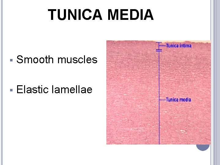 TUNICA MEDIA § Smooth muscles § Elastic lamellae 