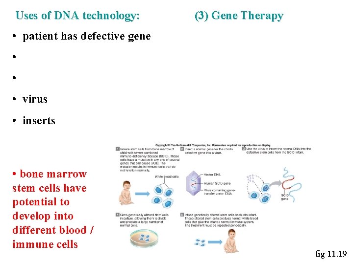 Uses of DNA technology: (3) Gene Therapy • patient has defective gene • •