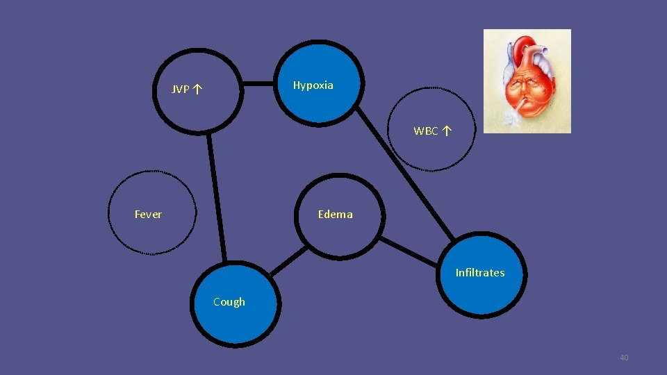 Hypoxia JVP ↑ WBC ↑ Fever Edema Infiltrates Cough 40 