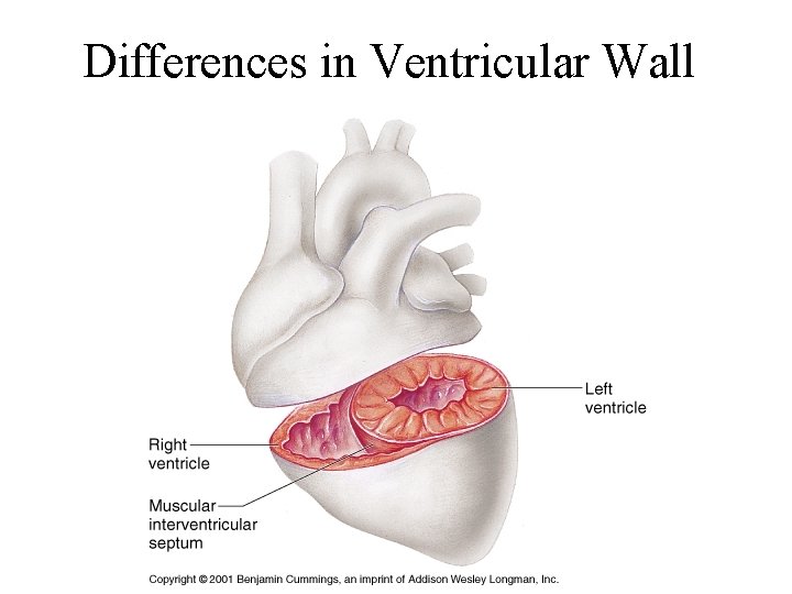 Differences in Ventricular Wall 