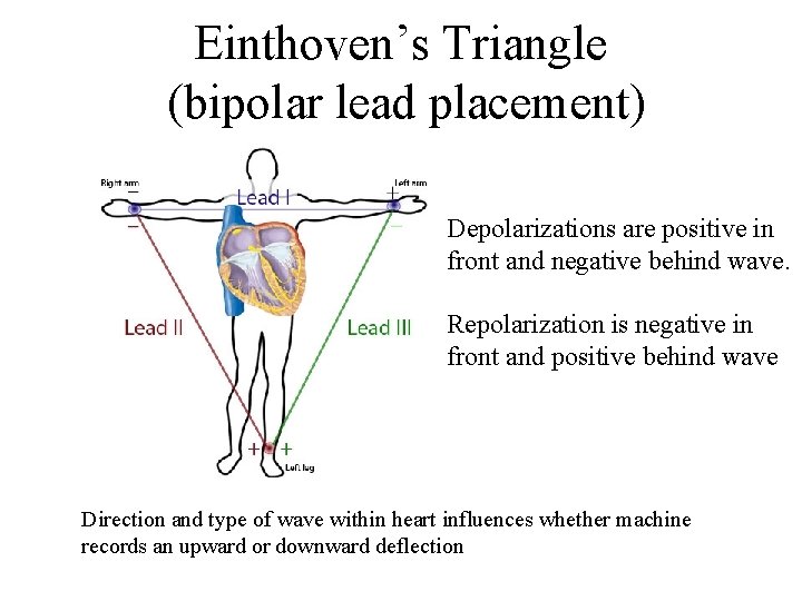 Einthoven’s Triangle (bipolar lead placement) Depolarizations are positive in front and negative behind wave.