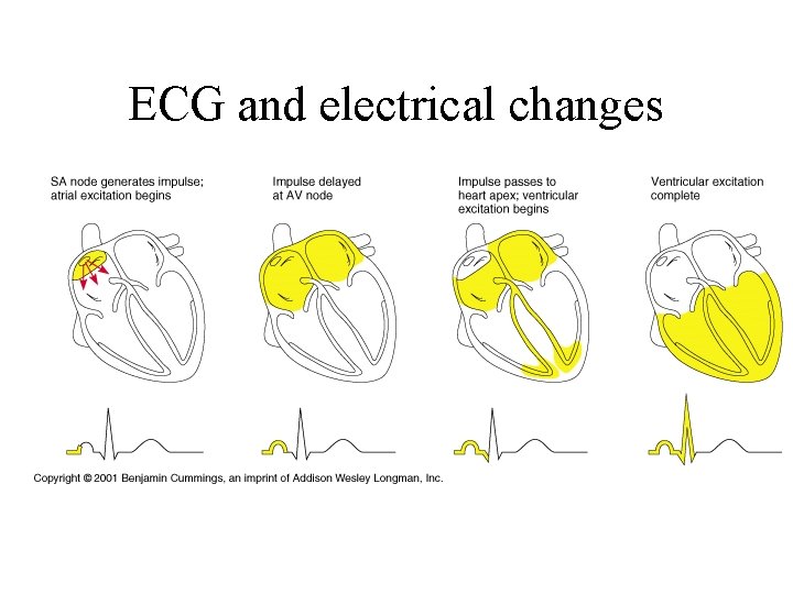 ECG and electrical changes 