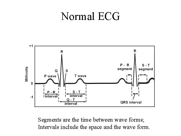 Normal ECG Segments are the time between wave forms; Intervals include the space and