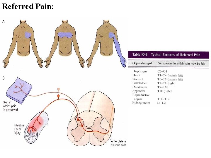 Referred Pain: 