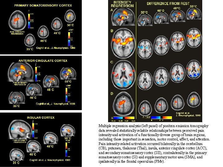 Multiple regression analysis (left panel) of positron emission tomography data revealed statistically reliable relationships