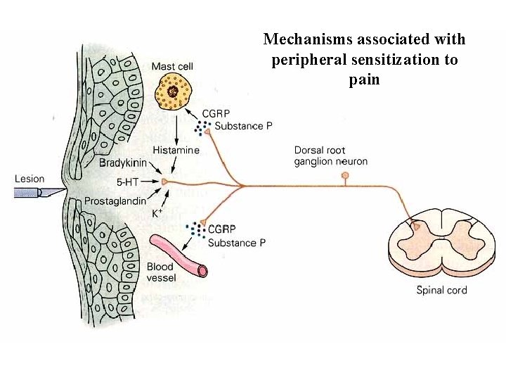 Mechanisms associated with peripheral sensitization to pain 