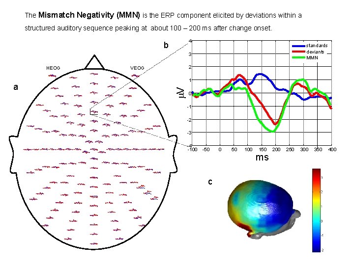 The Mismatch Negativity (MMN) is the ERP component elicited by deviations within a structured