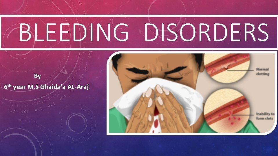 BLEEDING DISORDERS By 6 th year M. S Ghaida’a AL-Araj 