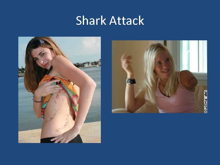 Shark Attack 