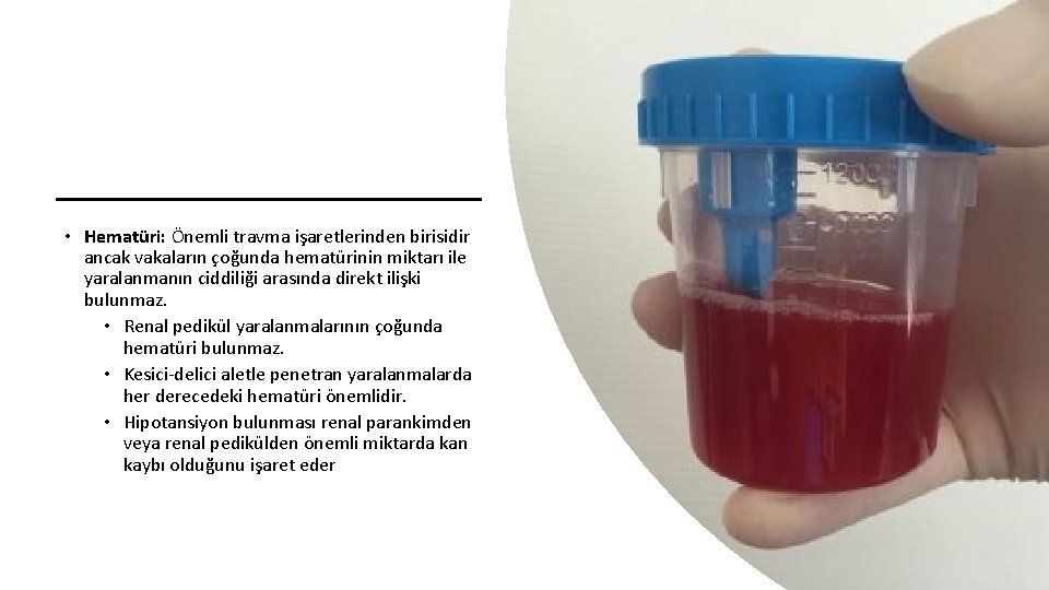 • Hematüri: Önemli travma işaretlerinden birisidir ancak vakaların çoğunda hematürinin miktarı ile yaralanmanın
