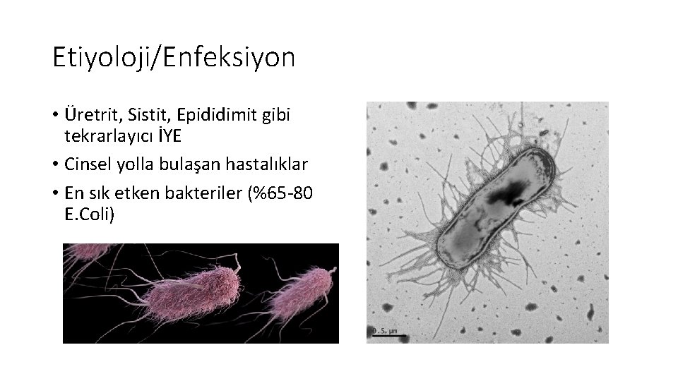 Etiyoloji/Enfeksiyon • Üretrit, Sistit, Epididimit gibi tekrarlayıcı İYE • Cinsel yolla bulaşan hastalıklar •