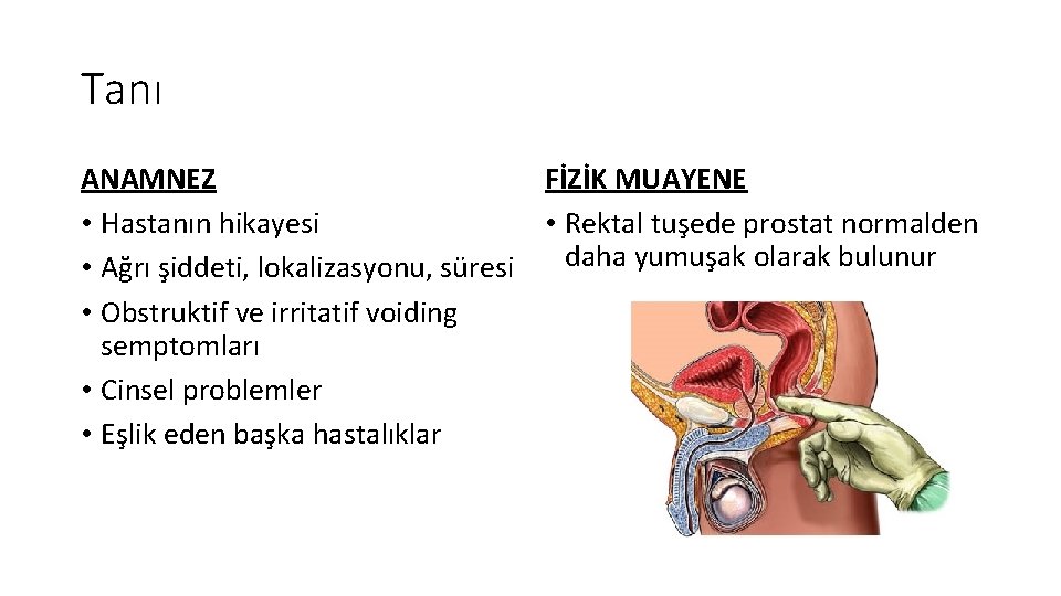 Tanı ANAMNEZ • Hastanın hikayesi • Ağrı şiddeti, lokalizasyonu, süresi • Obstruktif ve irritatif