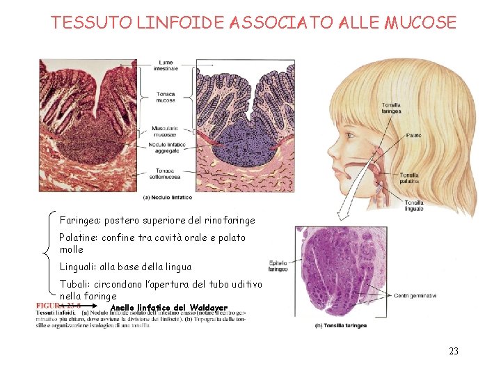 TESSUTO LINFOIDE ASSOCIATO ALLE MUCOSE Faringea: postero superiore del rinofaringe Palatine: confine tra cavità