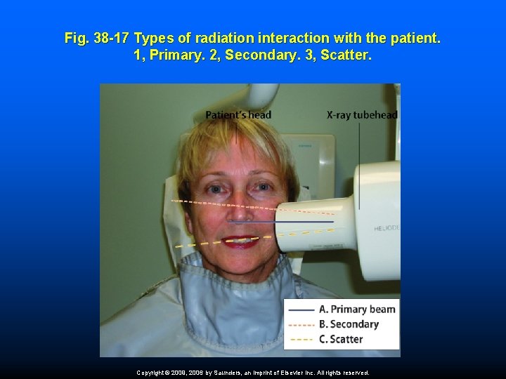 Fig. 38 -17 Types of radiation interaction with the patient. 1, Primary. 2, Secondary.