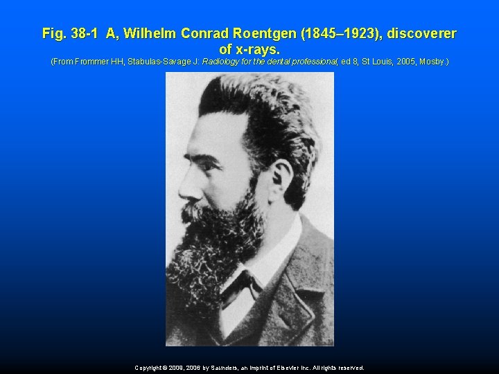 Fig. 38 -1 A, Wilhelm Conrad Roentgen (1845– 1923), discoverer of x-rays. (Frommer HH,