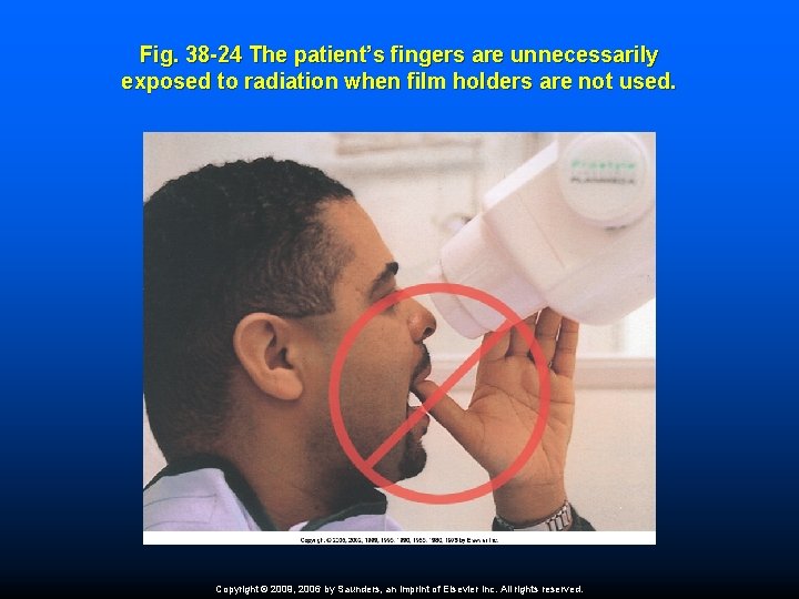 Fig. 38 -24 The patient’s fingers are unnecessarily exposed to radiation when film holders