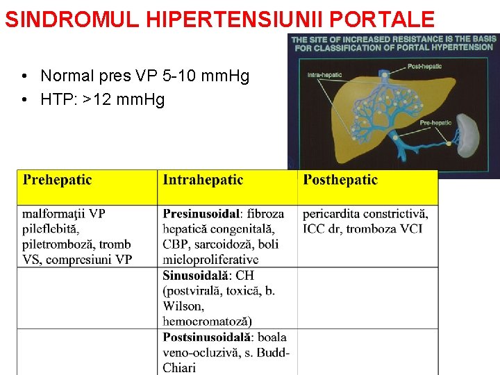 SINDROMUL HIPERTENSIUNII PORTALE • Normal pres VP 5 -10 mm. Hg • HTP: >12