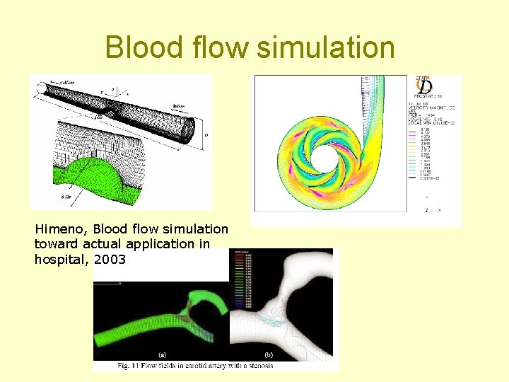 Blood flow simulation Himeno, Blood flow simulation toward actual application in hospital, 2003 