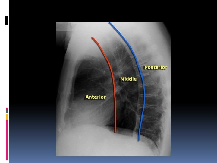 Differential diagnosis of chest diseases Dr Ahmed Refaey