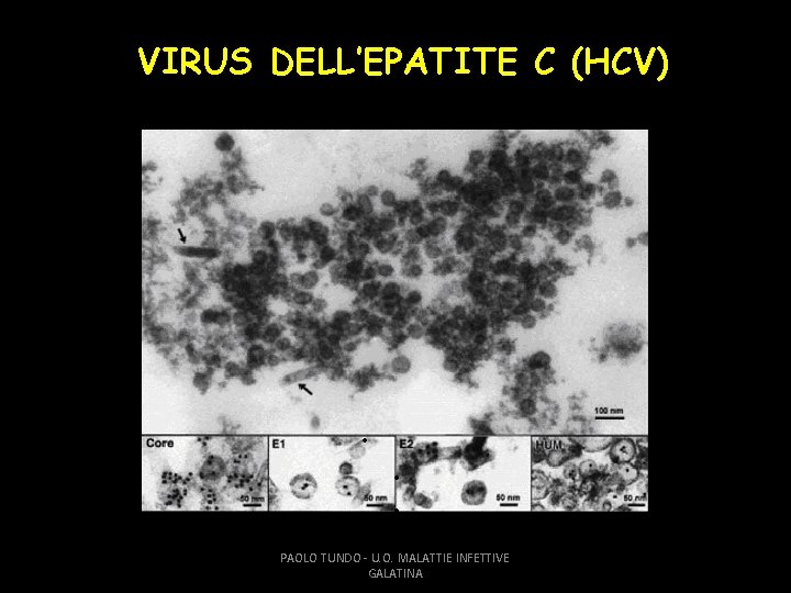 VIRUS DELL’EPATITE C (HCV) PAOLO TUNDO - U. O. MALATTIE INFETTIVE GALATINA 