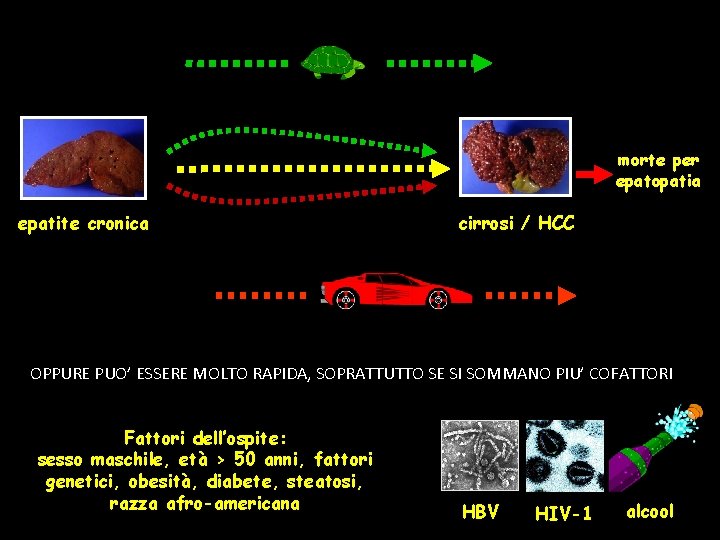 morte per epatopatia epatite cronica cirrosi / HCC OPPURE PUO’ ESSERE MOLTO RAPIDA, SOPRATTUTTO